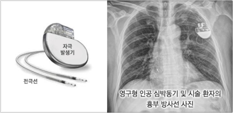 [출처] 대한심장학회 홈페이지