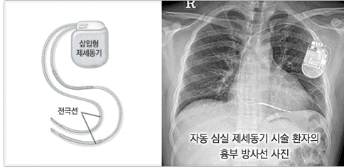 [출처] 대한심장학회 홈페이지