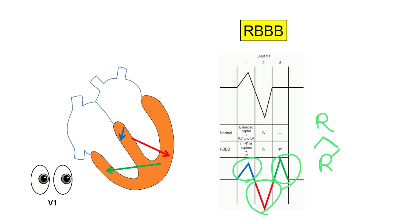 대한부정맥학회 Korean Heart Rhythm Society