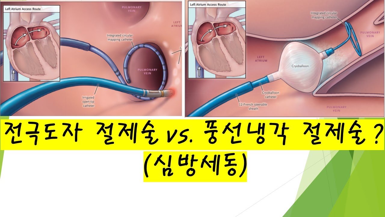 대한부정맥학회 Korean Heart Rhythm Society